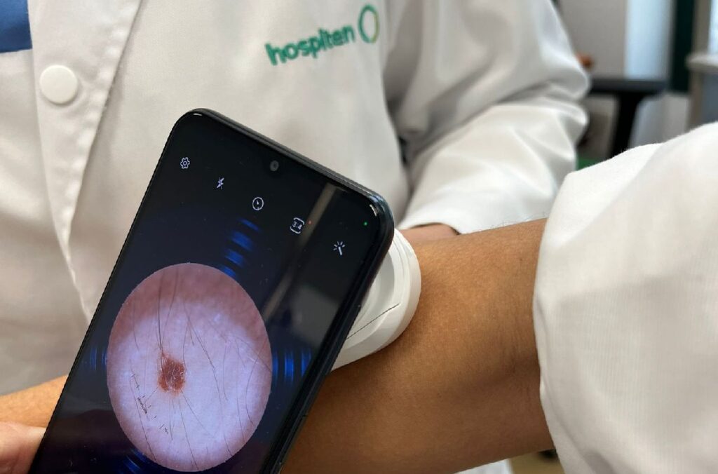 Hospiten incorpora tecnología avanzada para la detección temprana de lesiones en la piel