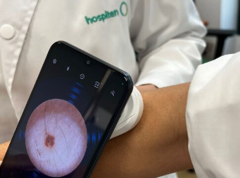 Hospiten incorpora tecnología avanzada para la detección temprana de lesiones en la piel