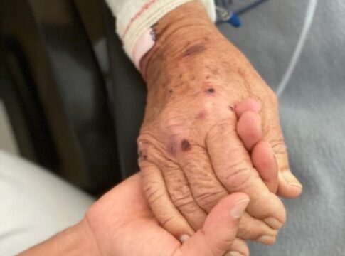 Más de 134.000 pacientes se benefician del programa AP_Cuida2 para el seguimiento en domicilio tras el alta