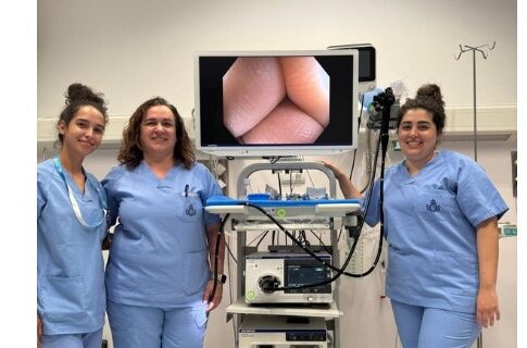 El Hospital San Juan de Dios de Tenerife impulsa el diagnóstico digestivo avanzado con nuevas técnicas de CPRE y ecoendoscopia