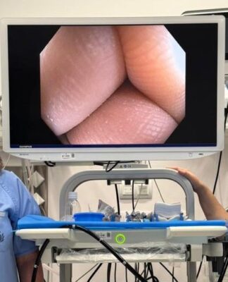 El Hospital San Juan de Dios de Tenerife impulsa el diagnóstico digestivo avanzado con nuevas técnicas de CPRE y ecoendoscopia